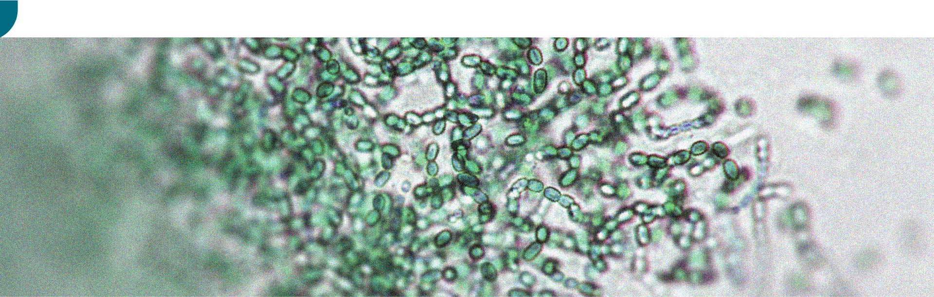 There is a relationship between gut microbiota and physical activity