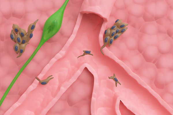 Cancer metastasis to blood vessels