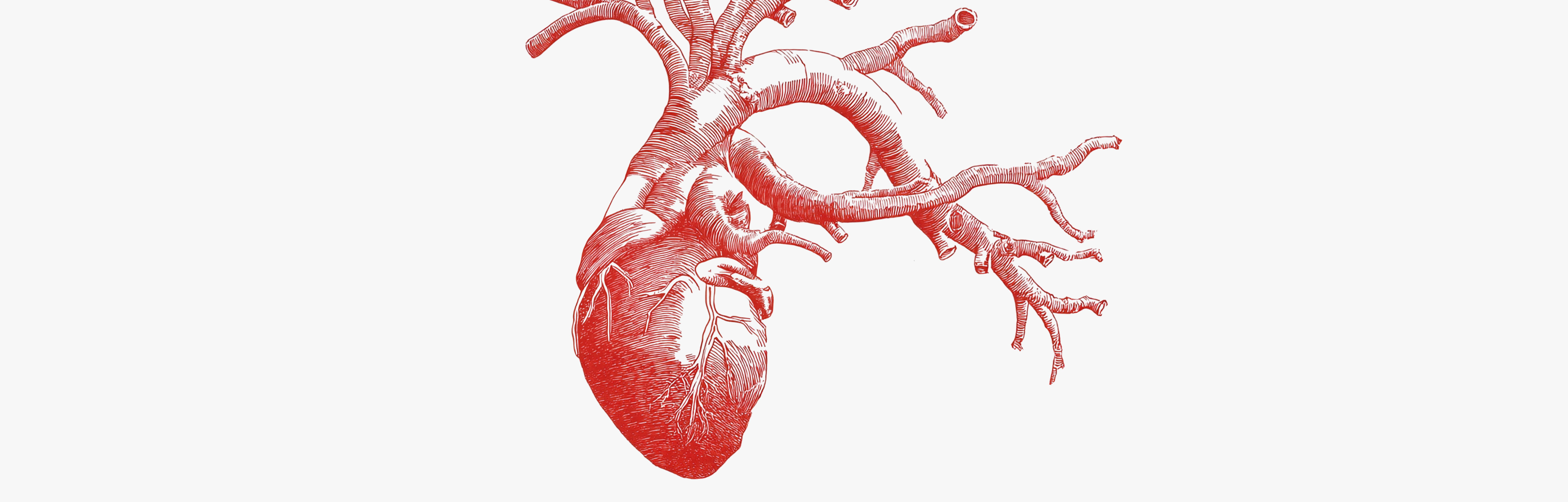 Excess homocysteine for the heart