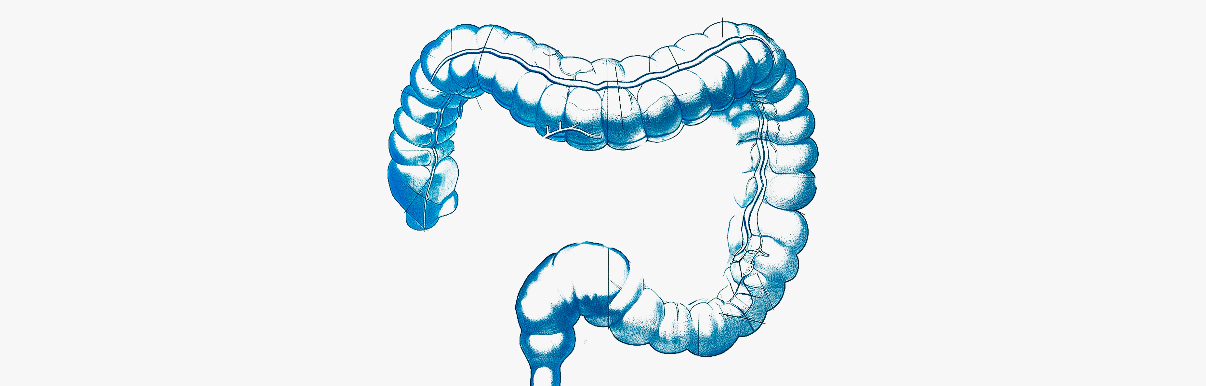 Colite et traitements pour l’intestin