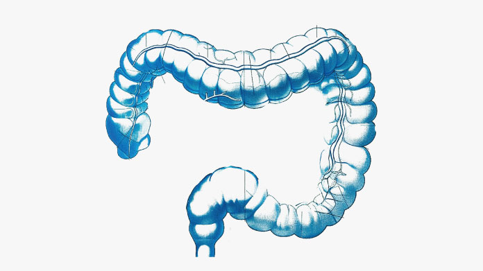 Colitis y tratamientos intestinales