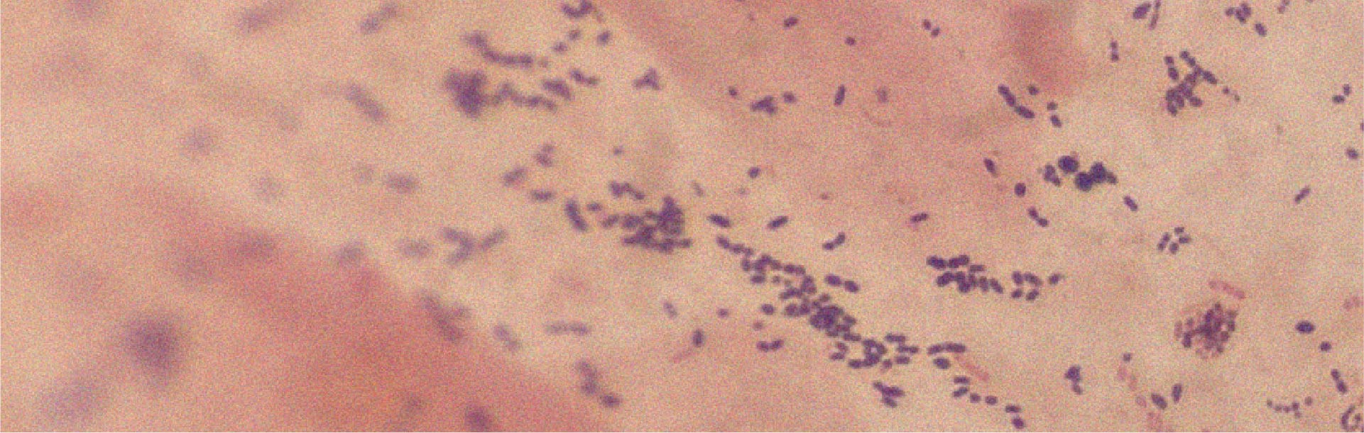 Tout ce qu’il faut savoir sur le Lactobacillus acidophilus