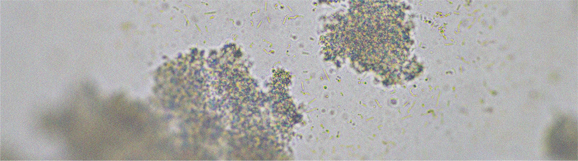 Probiotic strains that may help relieve diarrhoea