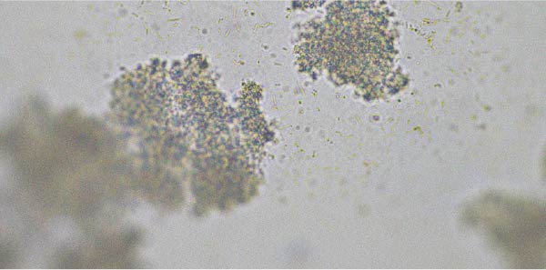 Probiotic strains that may help relieve diarrhoea