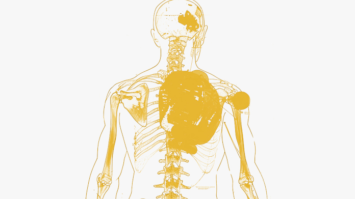 Person suffering from chronic inflammation